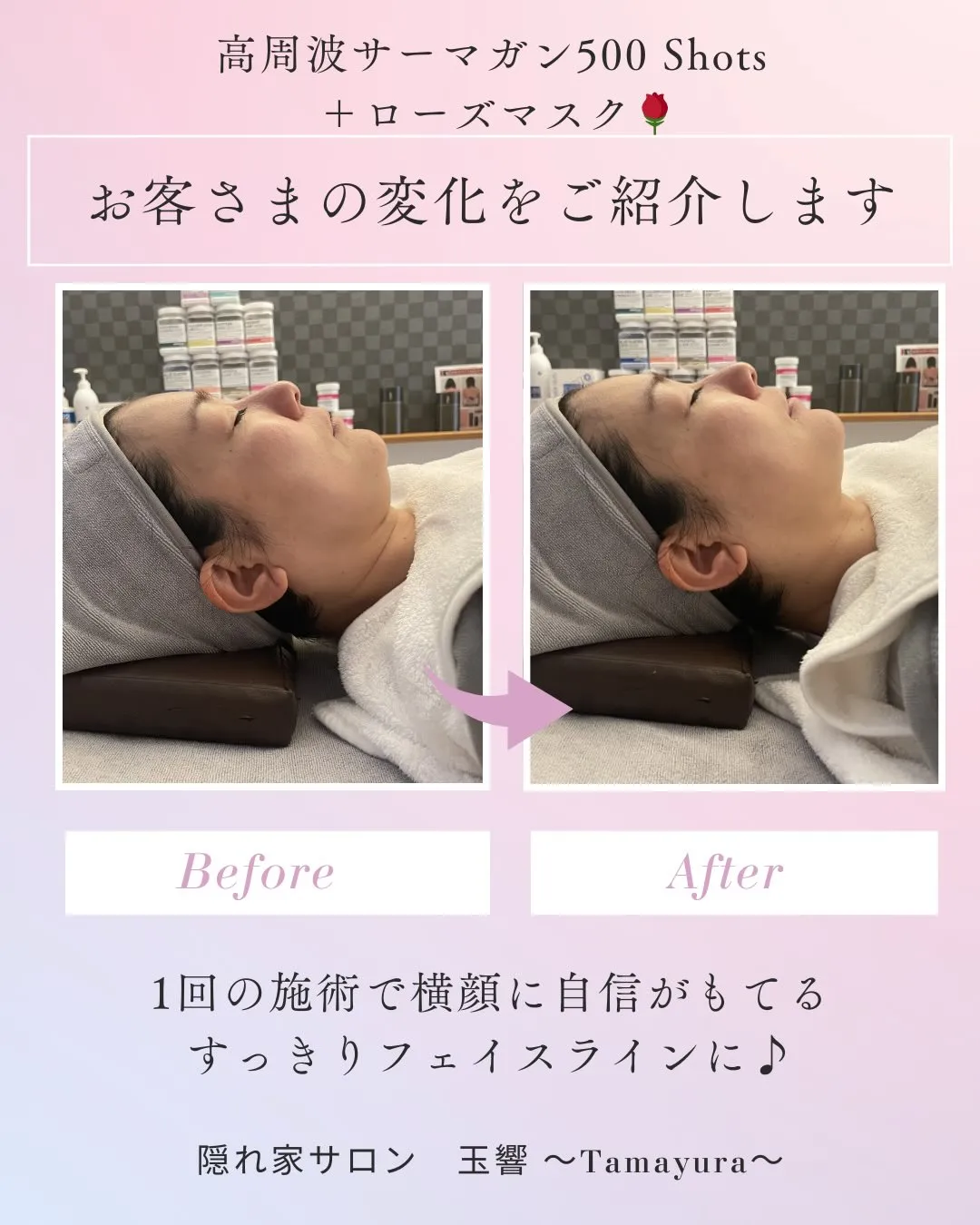 ふとした時の横顔に自信がありますか?